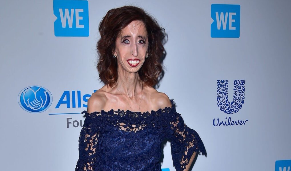 Lizzie Velasquez