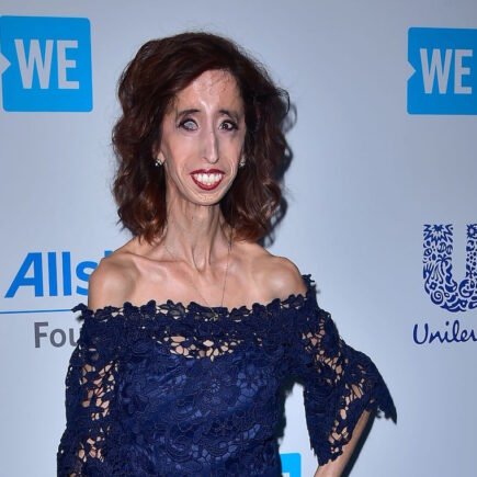 Lizzie Velasquez