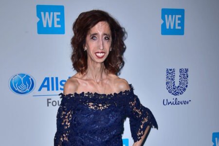 Lizzie Velasquez