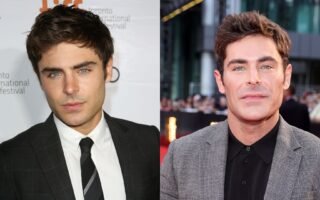 Zac Efron Face Accident