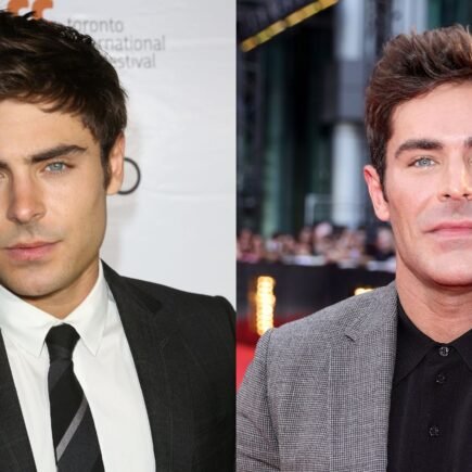 Zac Efron Face Accident