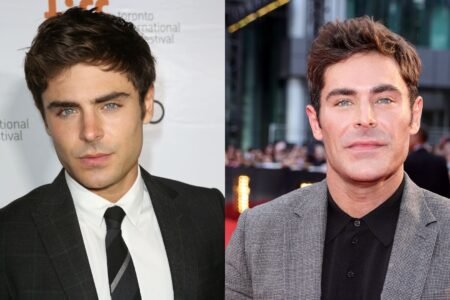 Zac Efron Face Accident