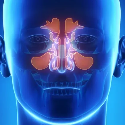 Constant Sinus Infections