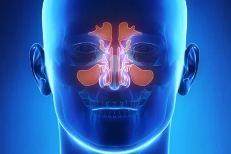 Constant Sinus Infections