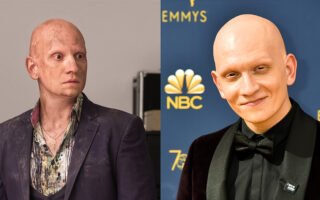 Anthony Carrigan