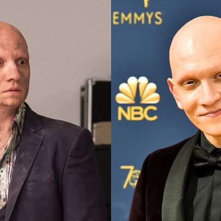 Anthony Carrigan